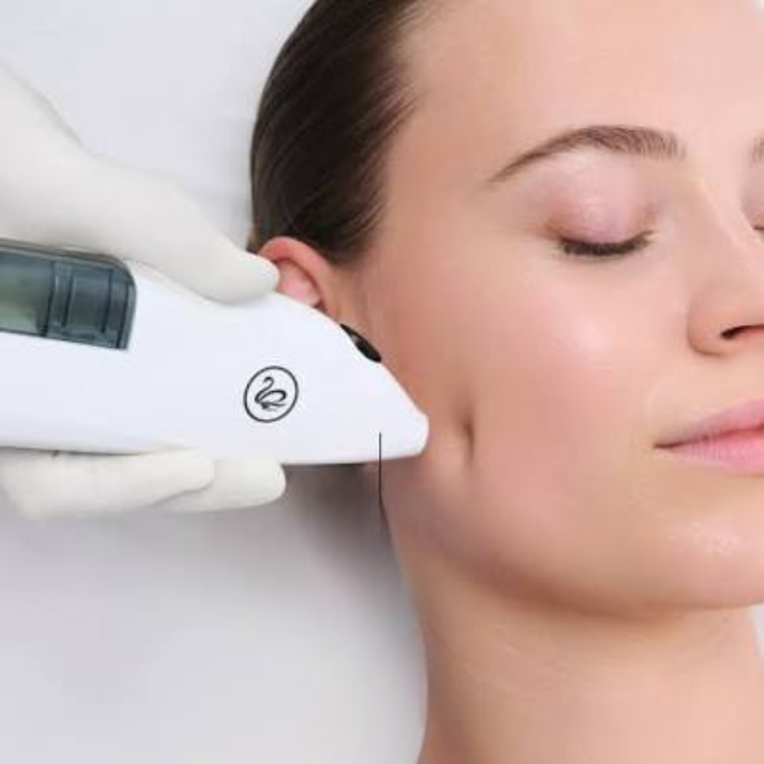 EXPERT JET- FILL – kyslíková jehla